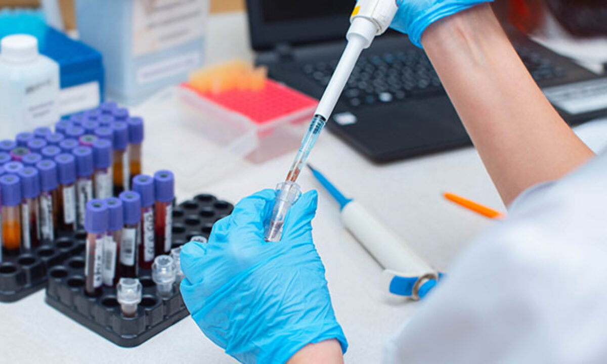 همه چیز درباره آزمایش های قبل از ازدواج دانستنی های آزمایش ازدواج